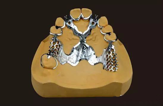 德国bego--bpd完美支架设计理念 一> - 义齿加工厂|假牙制造|洛阳雅浩